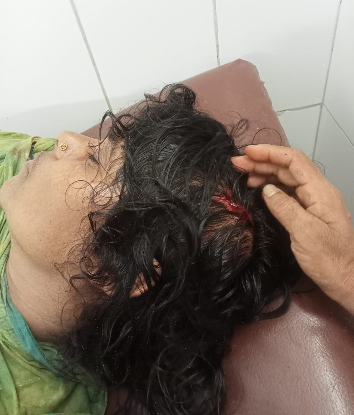 বীরগঞ্জে জমি বিরোধে বোনকে পিটিয়ে আহতের অভিযোগ, মাথায় গুরুতর জখম